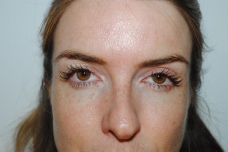 Clinique Pore Refining Solutions Instant Perfecting Makeup - before Clinique Pore Refining Solutions Instant Perfecting Makeup - before